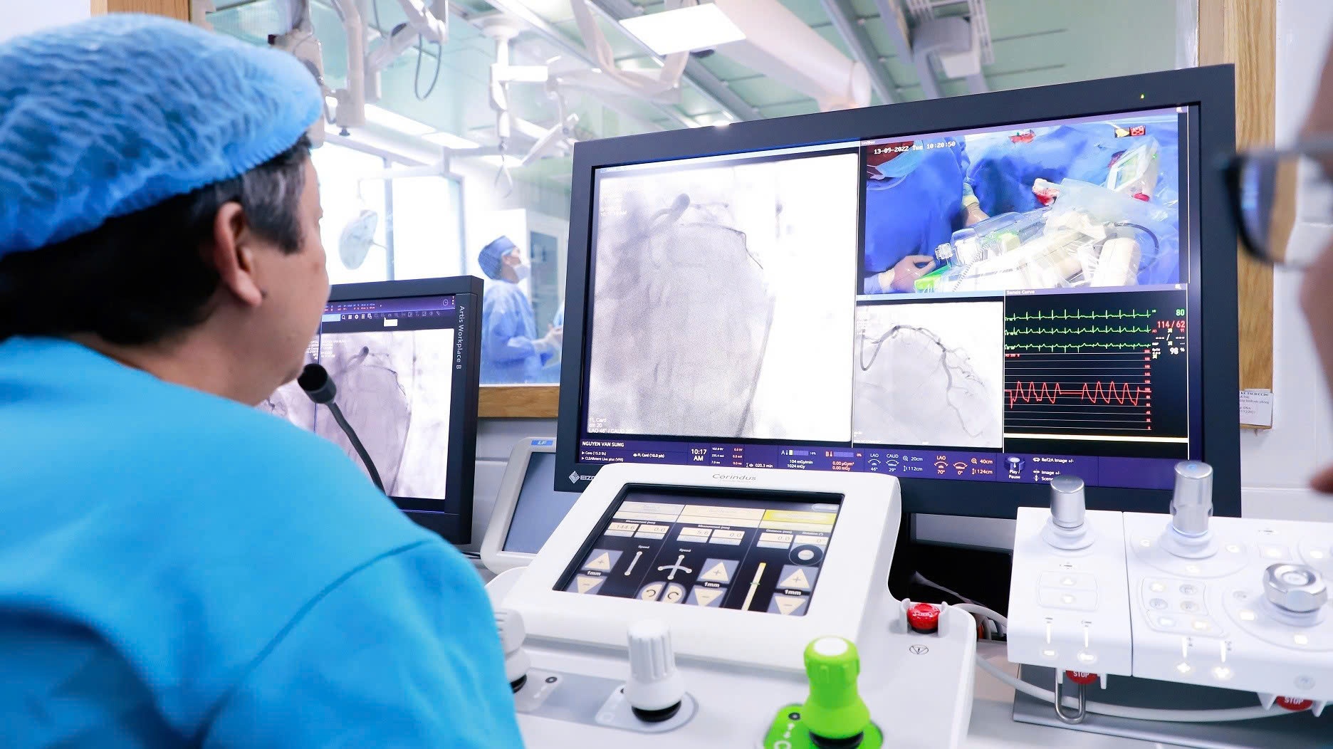 Nâng tầm can thiệp mạch Việt Nam bằng công nghệ DSA thế hệ mới