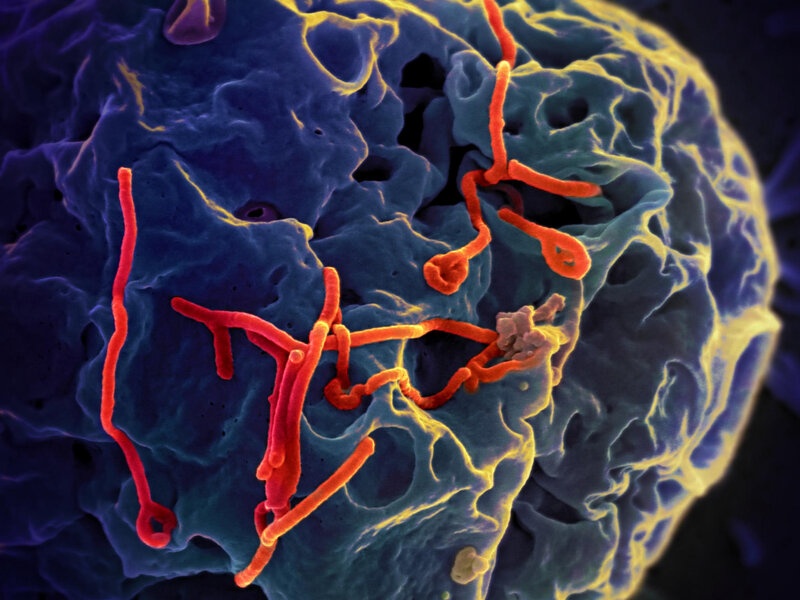 Bệnh Ebola có khả năng lây lan rất nhanh và tỷ lệ tử vong cao. Bệnh Ebola có khả năng lây lan rất nhanh và tỷ lệ tử vong cao.