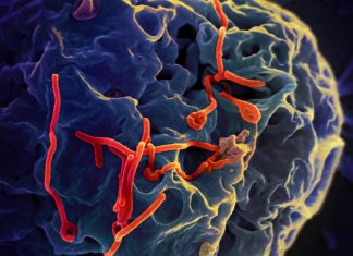 Bộ Y tế thông tin diễn biến phức tạp của dịch bệnh do virus Ebola